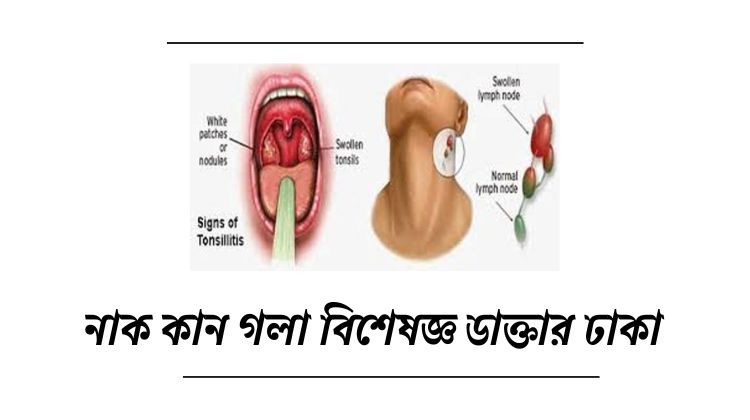 নাক কান গলা বিশেষজ্ঞ ডাক্তার ঢাকা