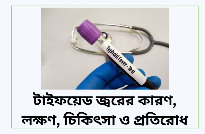 টাইফয়েড জ্বরের কারণ, লক্ষণ, চিকিৎসা ও প্রতিরোধ