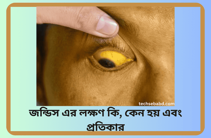 জন্ডিস এর লক্ষণ কি, কেন হয় এবং প্রতিকার